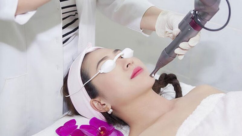 trị nám bằng laser