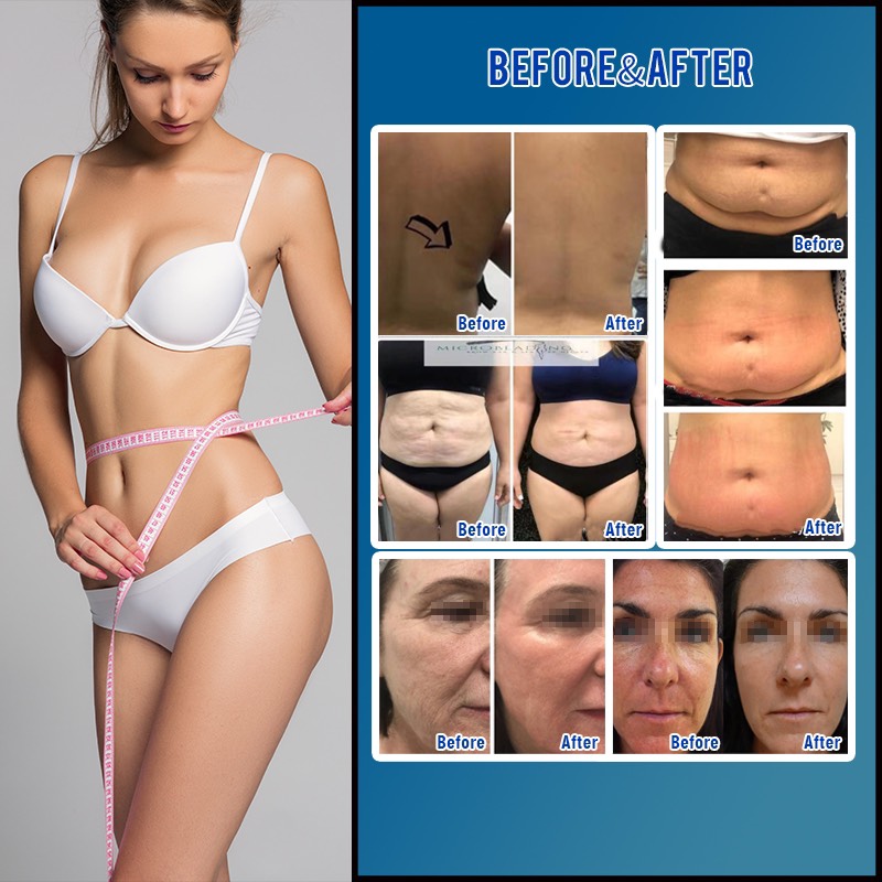 may giam beo 360multi velashape slimming 3