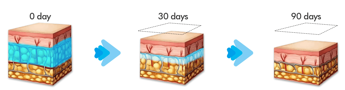 may giam beo quang dong 360 cryolipolysis 2