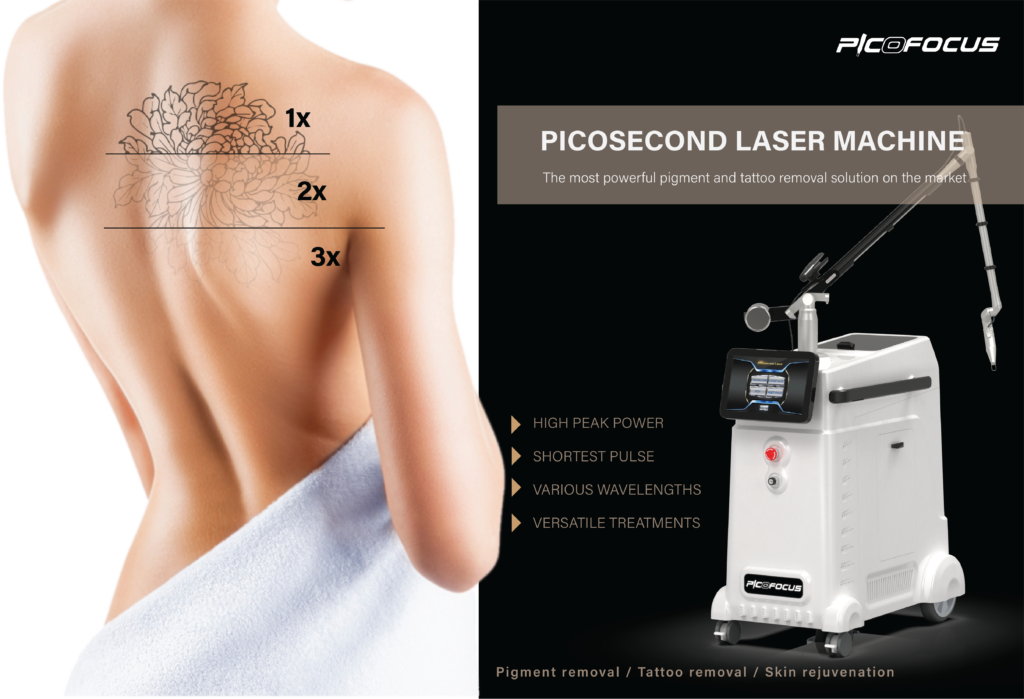 may laser xoa xam tri nam picofocus 1