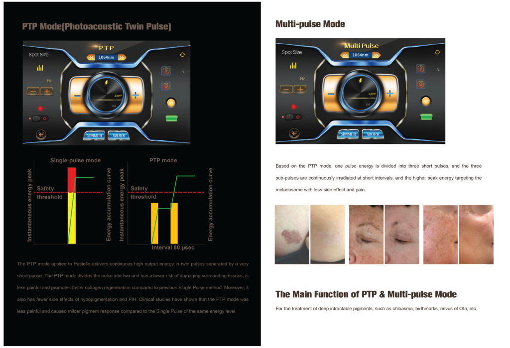 may laser xoa xam tri nam picofocus 5