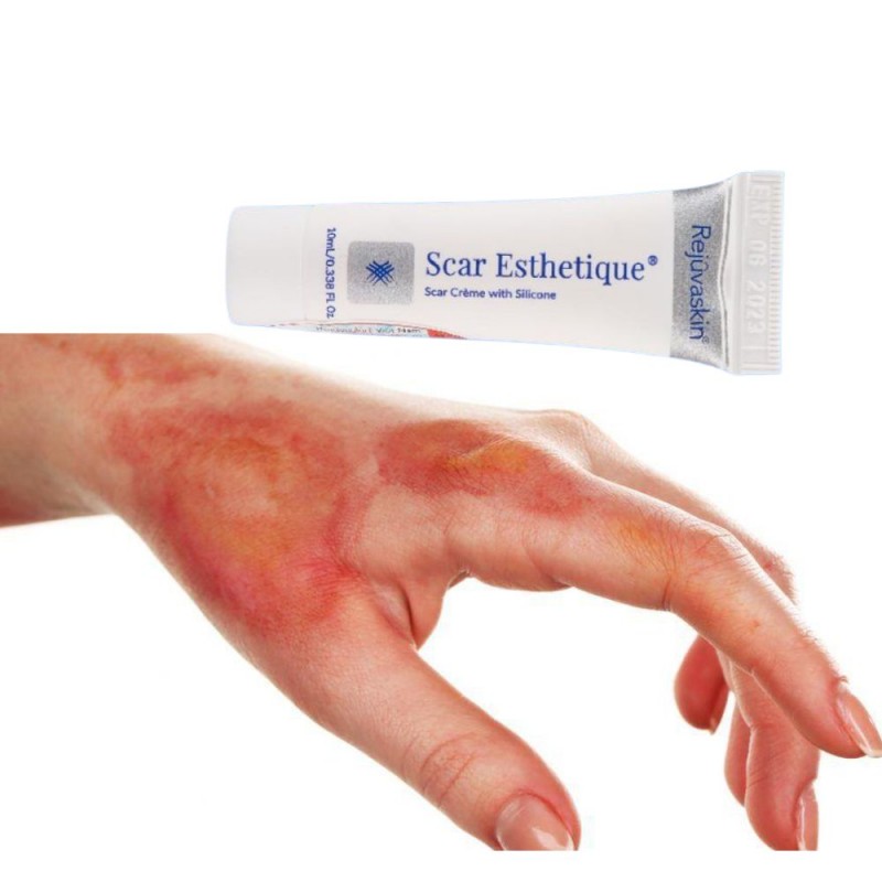 thuốc trị sẹo bỏng nước sôi