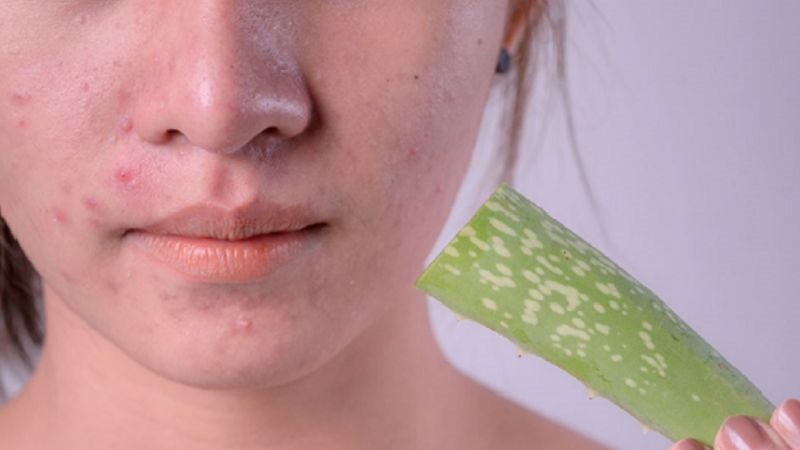 nha đam trị sẹo
