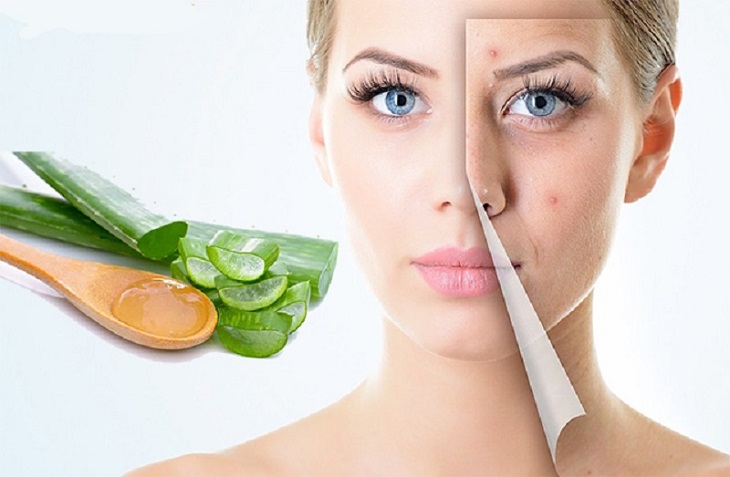 trị sẹo mụn thâm bằng nha đam